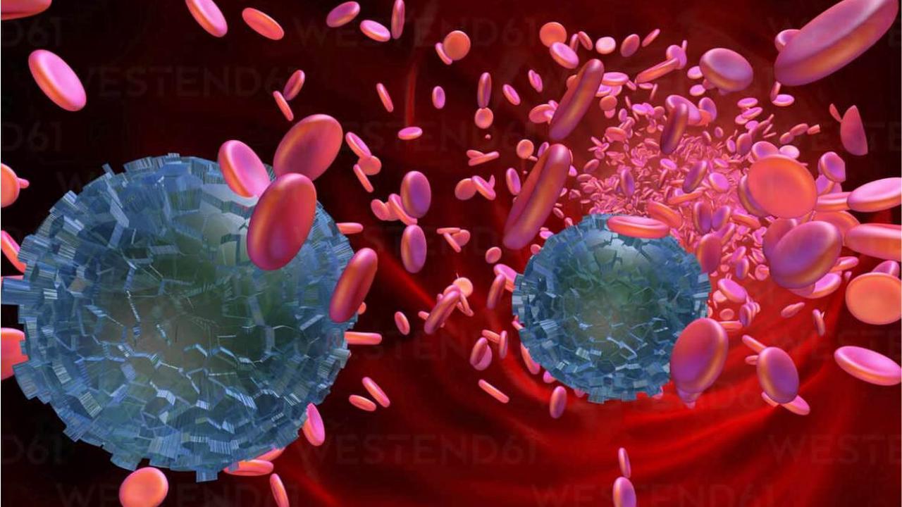 مطالعات جدید وجود میکروپلاستیک‌ها در خون انسان را تایید کردند