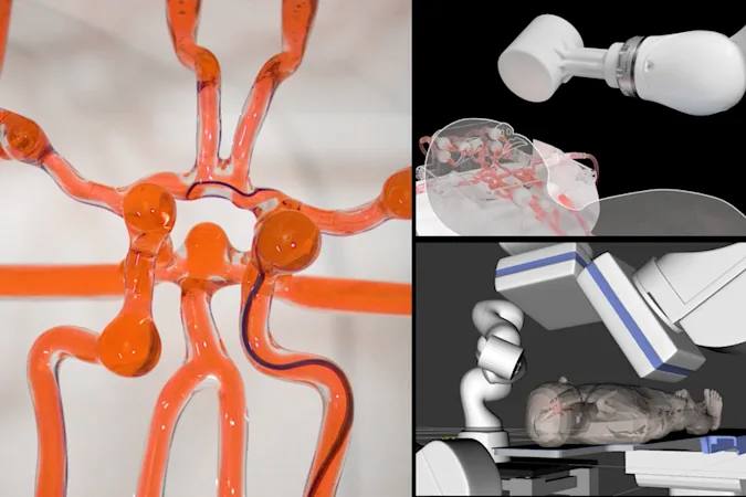 مهندسان دانشگاه MIT توانستند تا رباتی را برای جراحی مغز تولید کنند